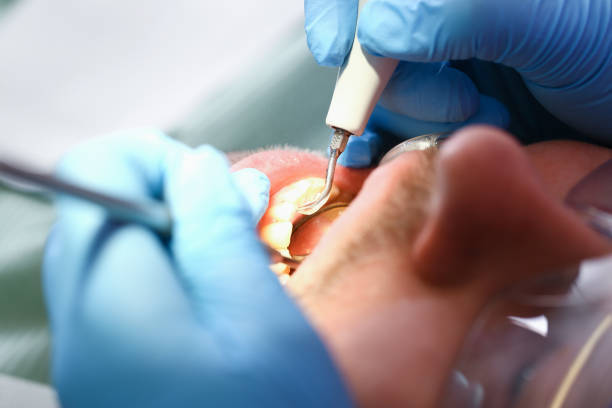  Airport, CA Emergency Dentist Pros