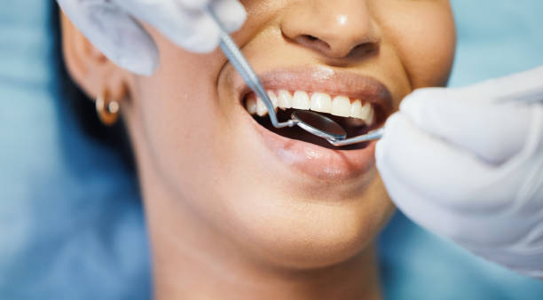 Best Teeth Whitening  in Airport, CA